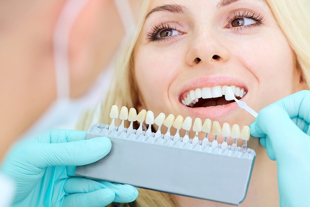 Why Choose Our Dental Whitening Treatment