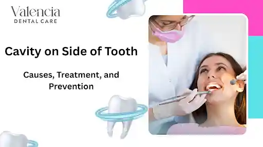 cavity on side of teeth