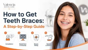 featured image for how to get teeth braces
