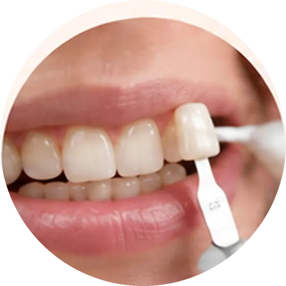 Prepare tooth